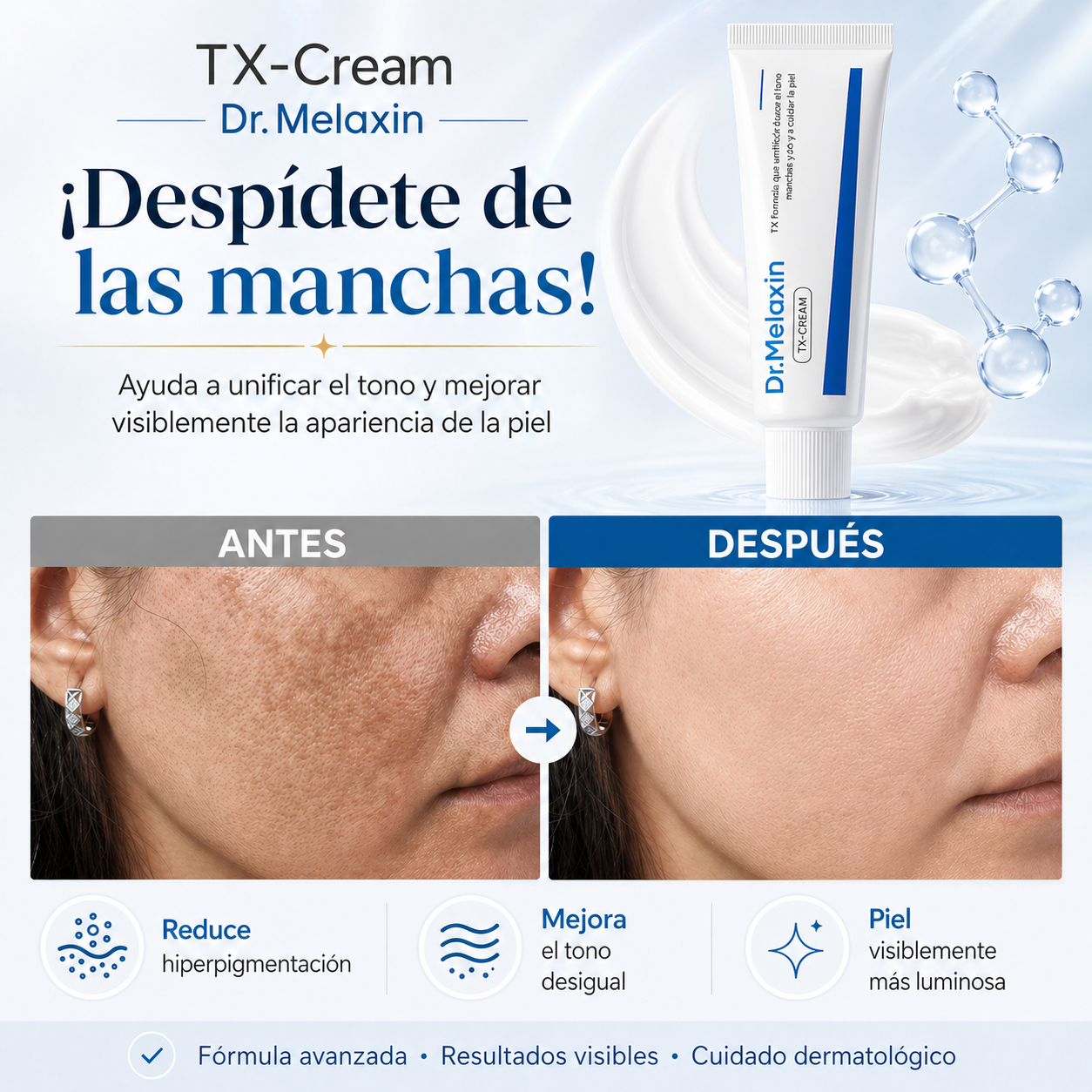TX-CREAM DR.MELAXIN™️l ¡ADIOS MANCHAS! ACNE,MELASMA Y MÁS