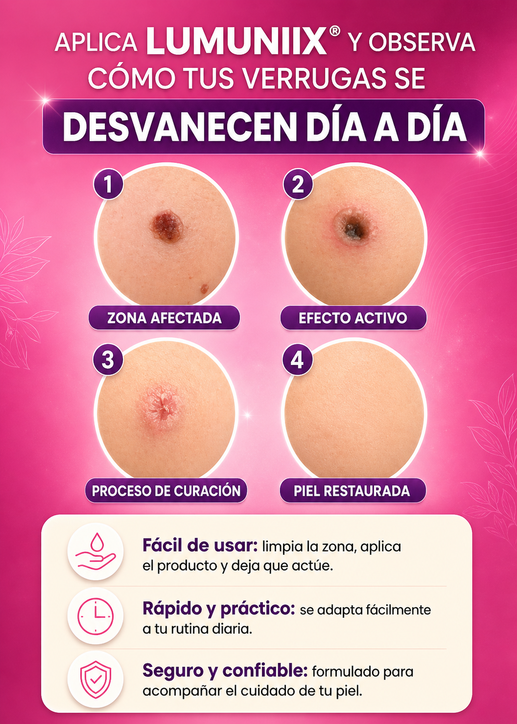 LUMINIIX®l ¡ADIOS VERRUGAS!