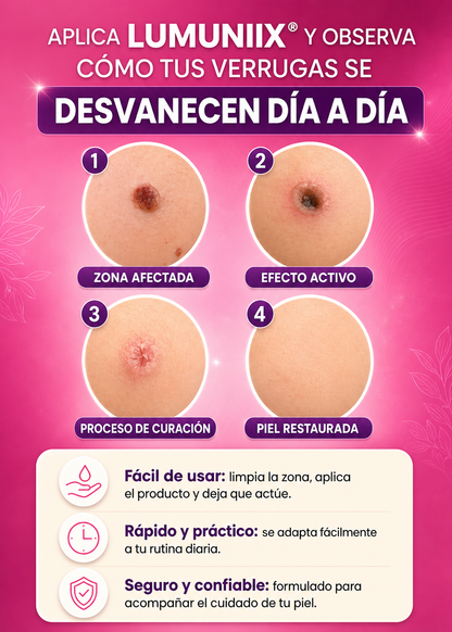 LUMINIIX®l ¡ADIOS VERRUGAS!