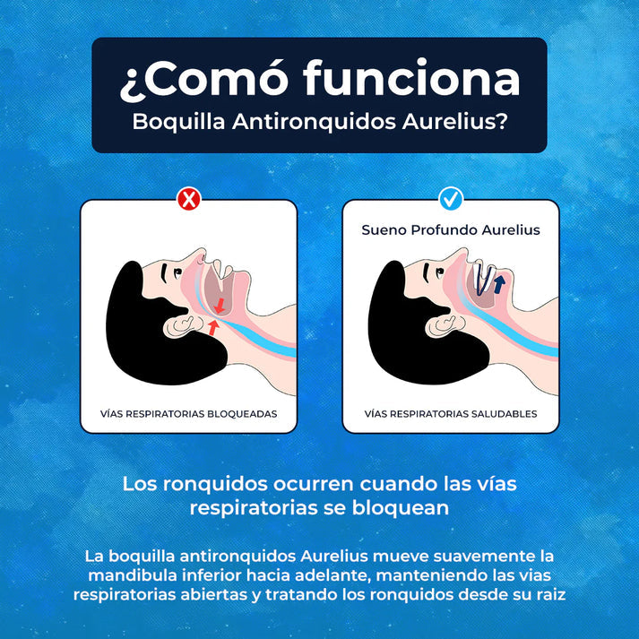 BOQUILLA ANTIRRONQUIDOS™️-AURELIUS l DESCANSO TOTAL