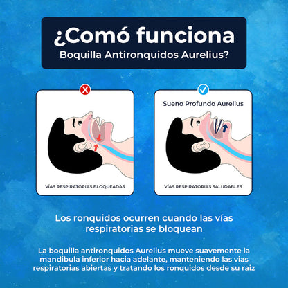 BOQUILLA ANTIRRONQUIDOS™️-AURELIUS l DESCANSO TOTAL