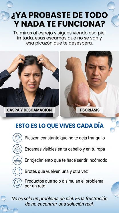 ROYCEDERM™️: DESASTE DE LA CASPA,DERMATITIS Y PSORIASIS
